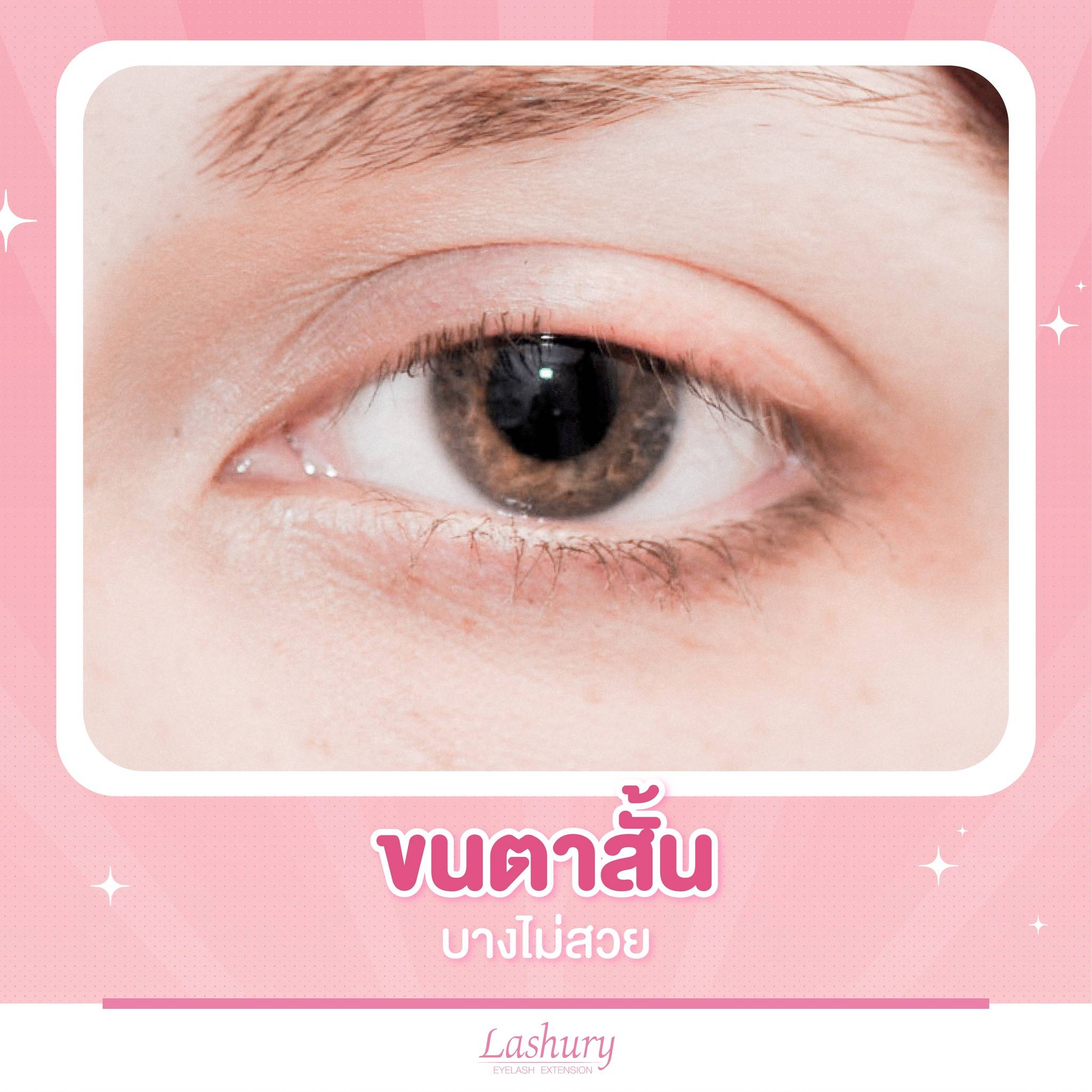 ขนตาสั้น ขนตาบาง ขนตาน้อย กรรมพันธุ์ ขนตาแบบไหน ต้องพักบำรุงขนตาก่อนต่อขนตา
