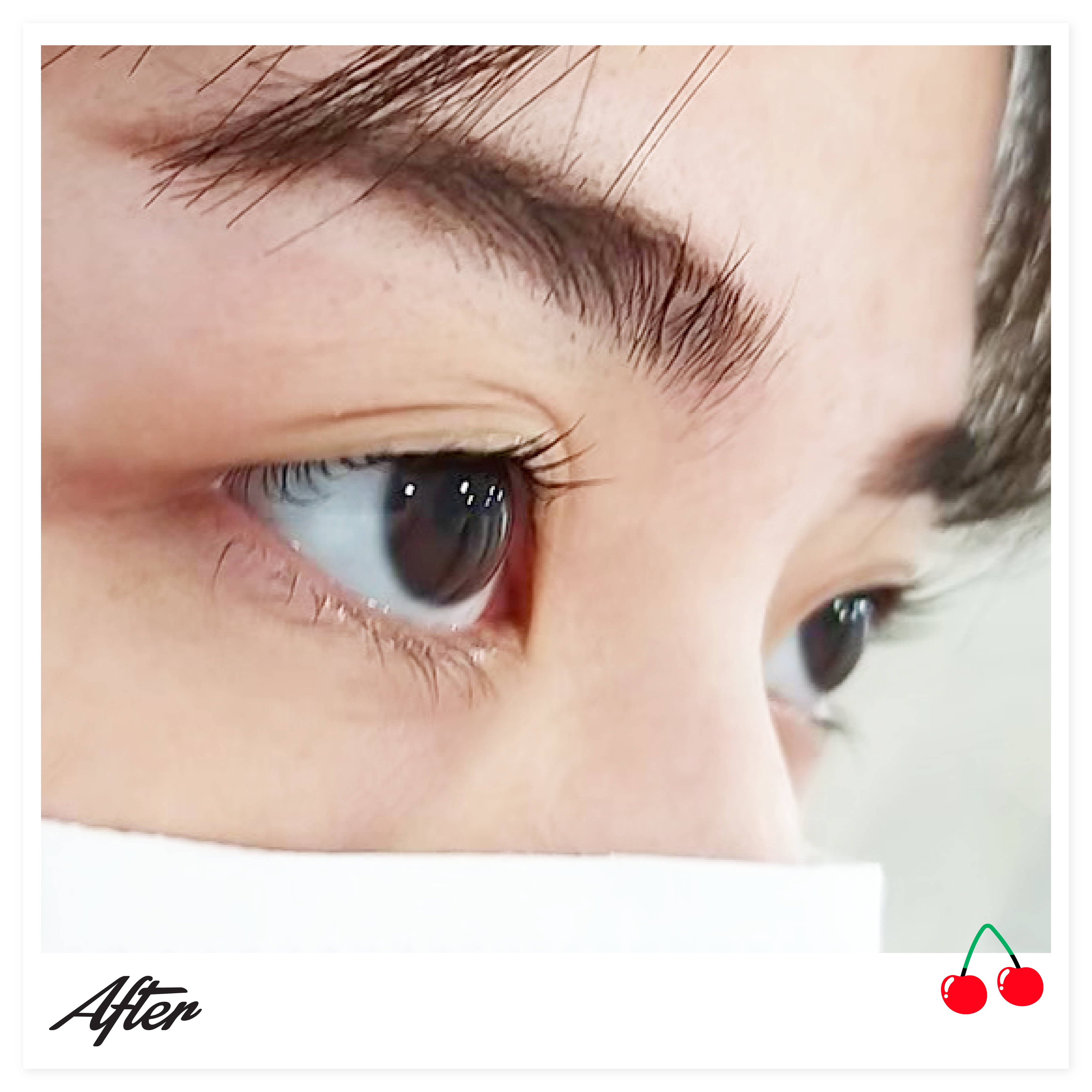 ลิฟติ้งขนตาคืออะไร